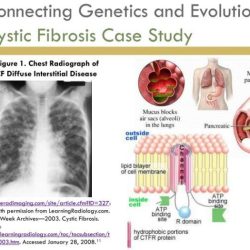 Case study cystic fibrosis answers